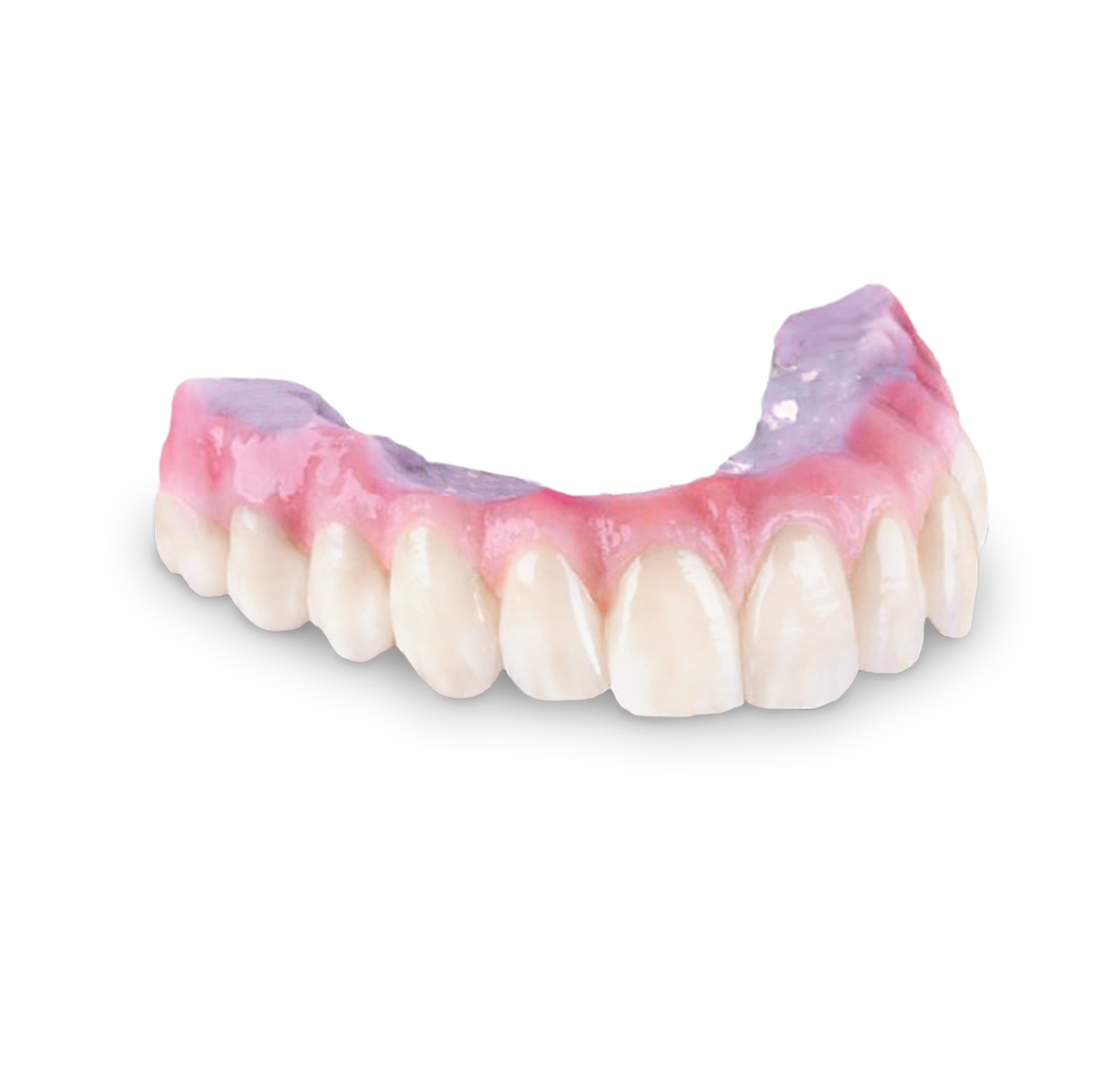 Full-arch zirconia hybrid prosthesis