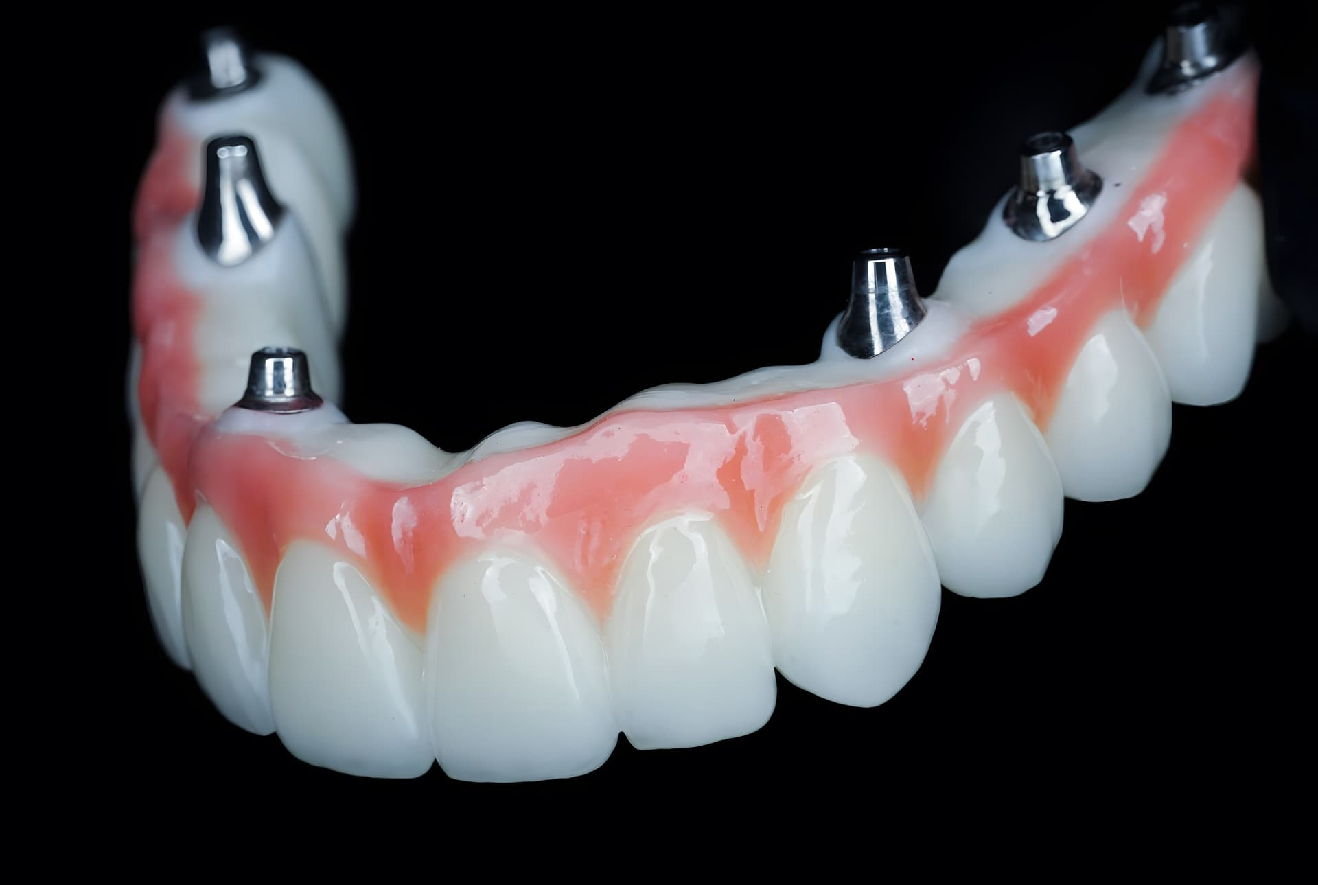 Full-arch zirconia restoration by Megatec Dental Lab