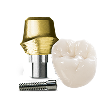 Titanium implant solution with zirconia crown