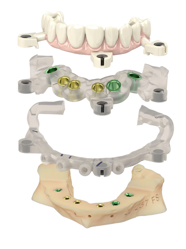 Stackable surgical guide, zirconia prosthesis and dental model by Megatec Dental Lab