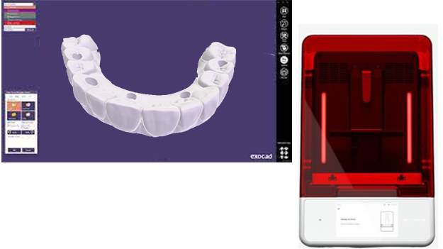PMMA – Design & 3D Print