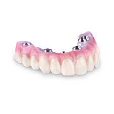 Zirconia Full-Arch Implant Prosthesis